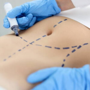 Advantages Of Abdominoplasty: More Than Only Cosmetic Surgery